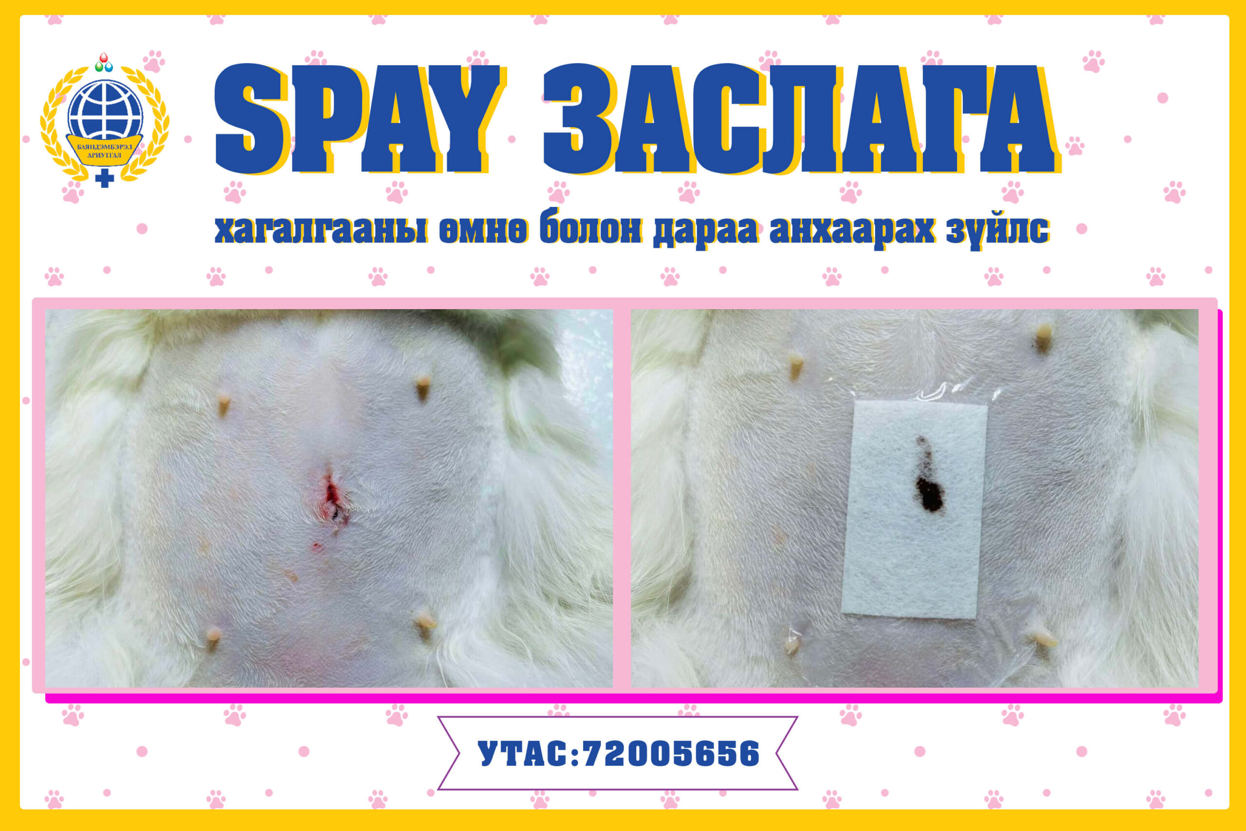 SPAY заслага хагалгааны өмнө болон дараа анхаарах зүйлс