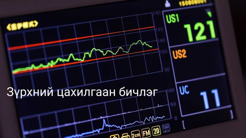 Зүрх өвдөх