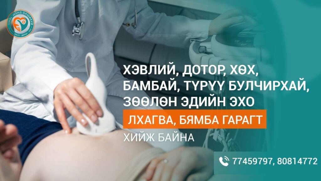 ЭХО