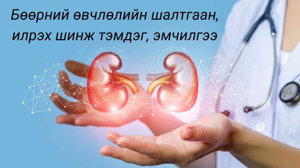 бөөр өвдөх