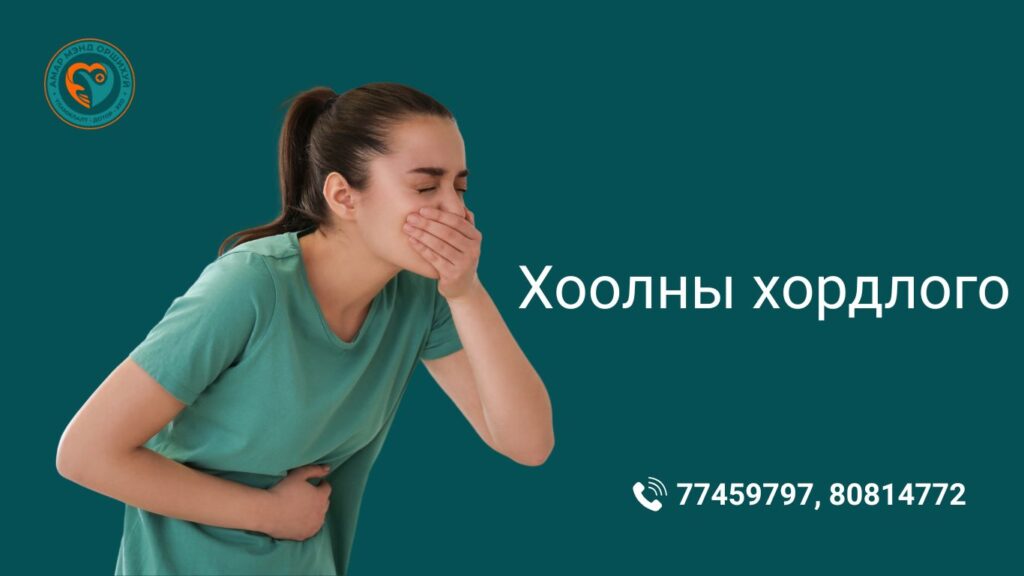 хоолны хордлого