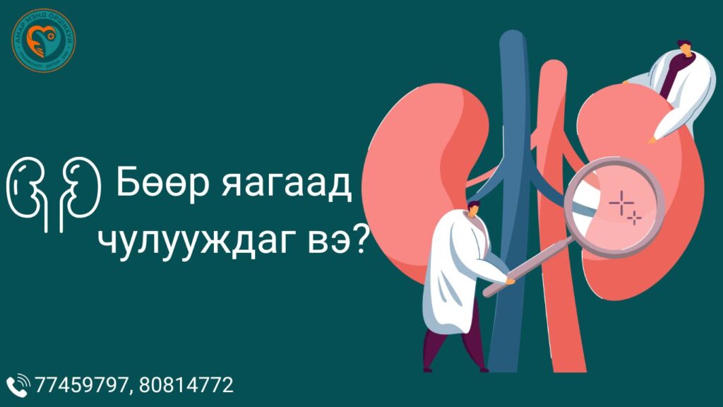 Бөөр өвдөх